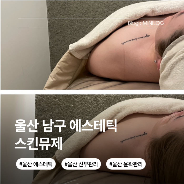 스킨뮤제 이미지