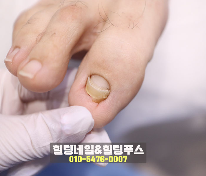 힐링네일&힐링푸스 이미지
