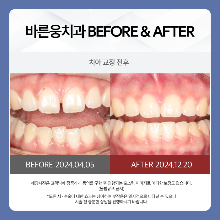 바른웅치과의원 이미지