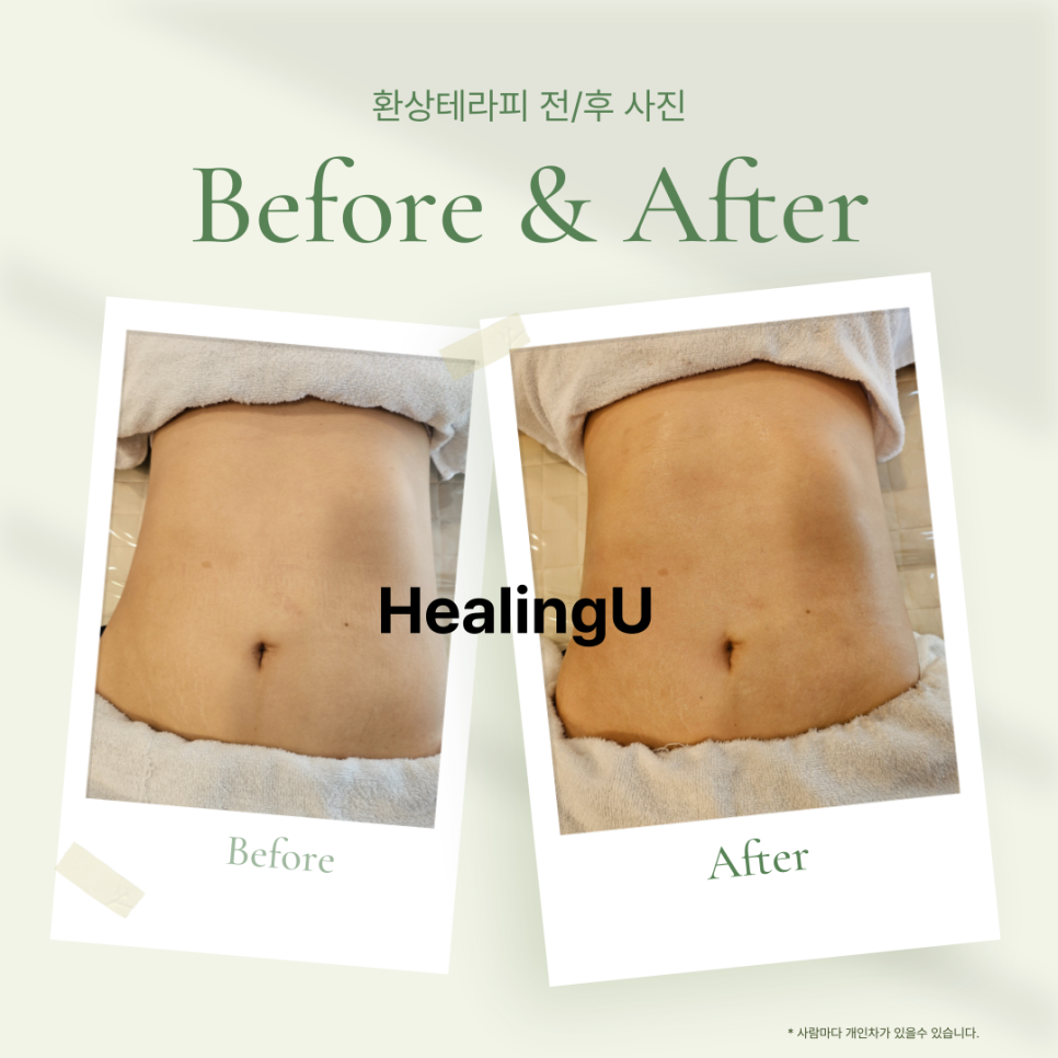 유주테라피 이미지