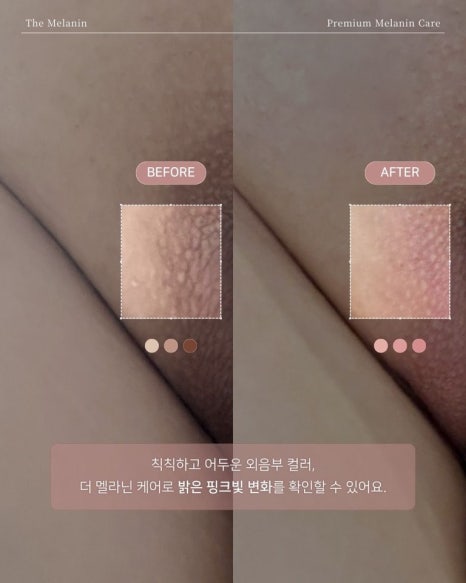 이유토탈케어 이미지