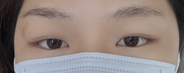 모노아이룸 이미지