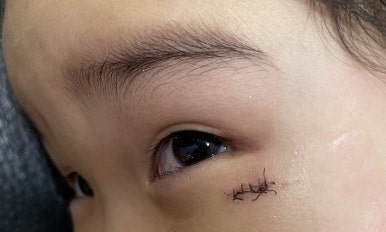 미테크 이미지