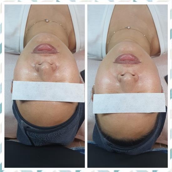 수정뷰티 이미지