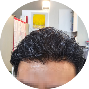플러스모발센터 이미지