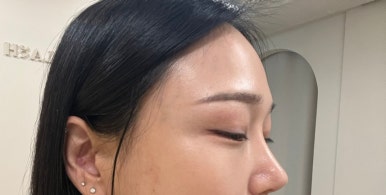 에이치래쉬 이미지
