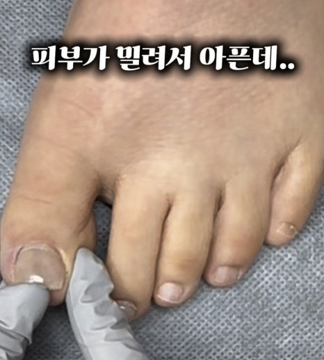 골드문네일 이미지