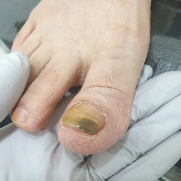 오로지푸스앤네일 이미지