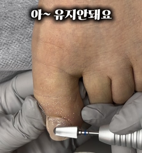 골드문네일 이미지