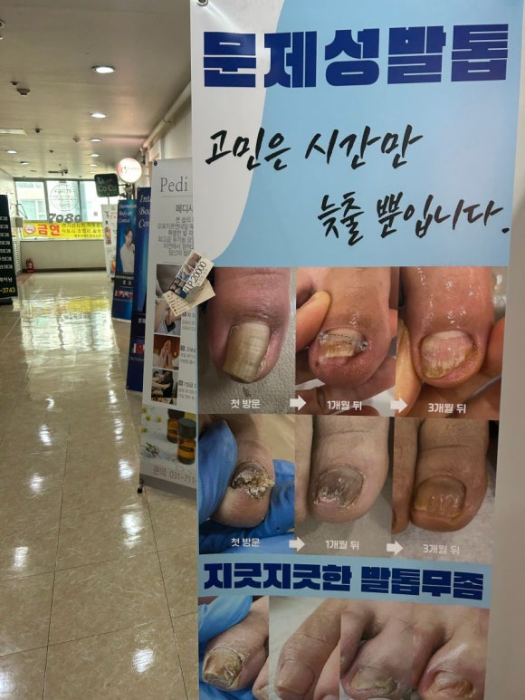 오로지푸스앤네일 이미지