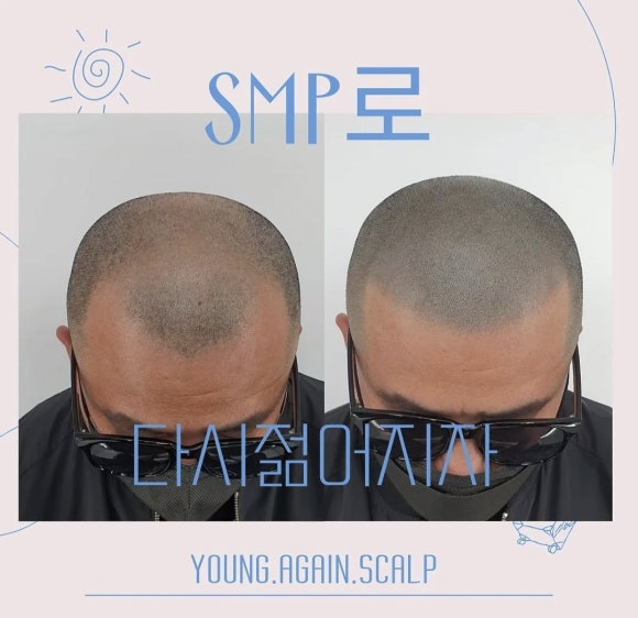 영어게인 이미지