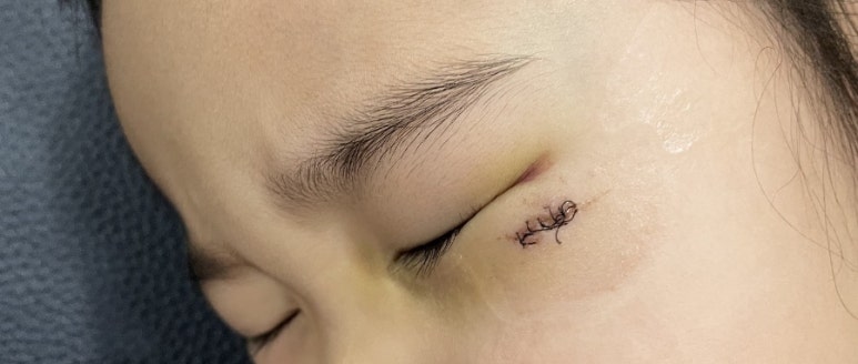 미테크 이미지
