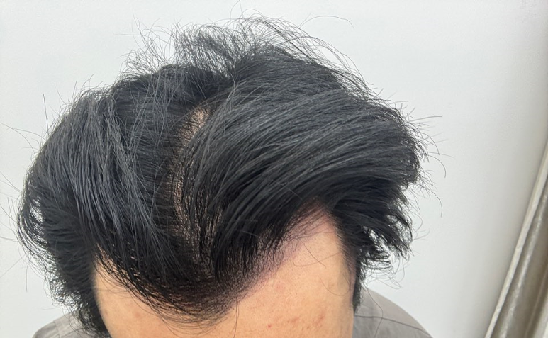 뷰티헤어라인 이미지
