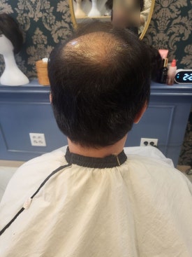 모두스가발 이미지