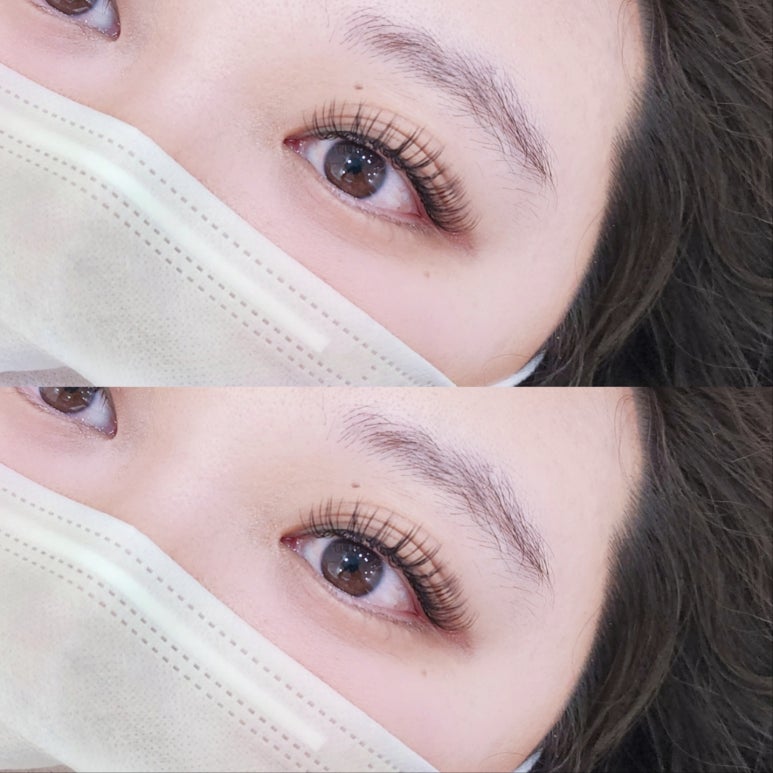 아이뷰티 이미지