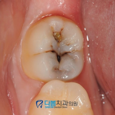 다봄치과 이미지