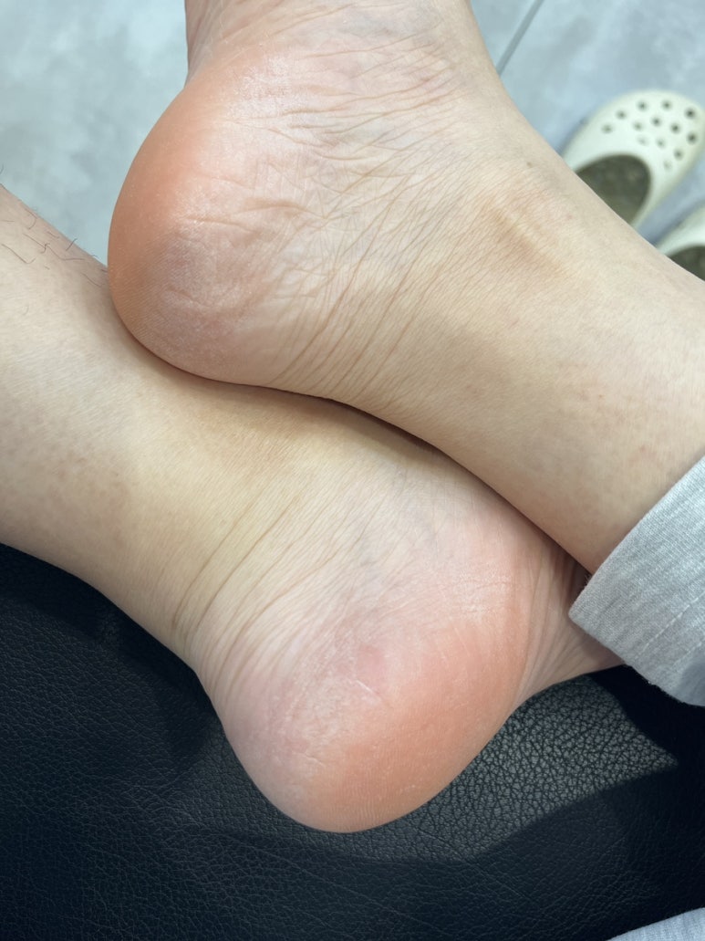 포쉬네일용인더와이 이미지
