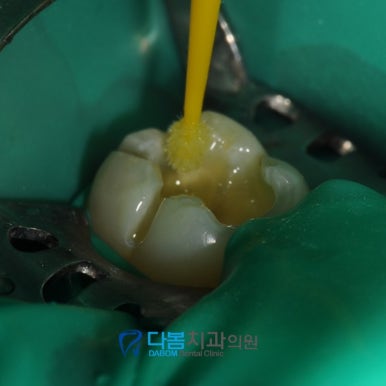 다봄치과 이미지