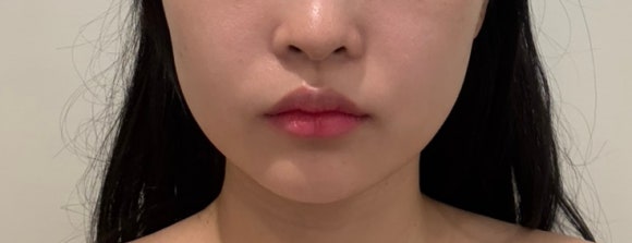 맑음조각 이미지