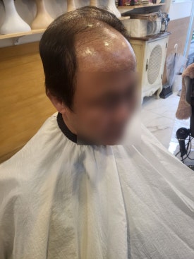 모두스가발 이미지