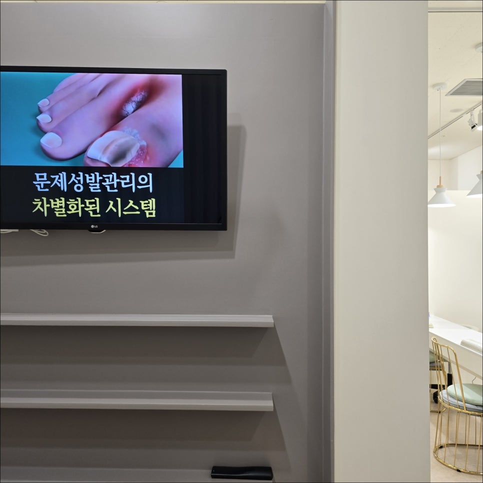 에스(S)네일 이미지