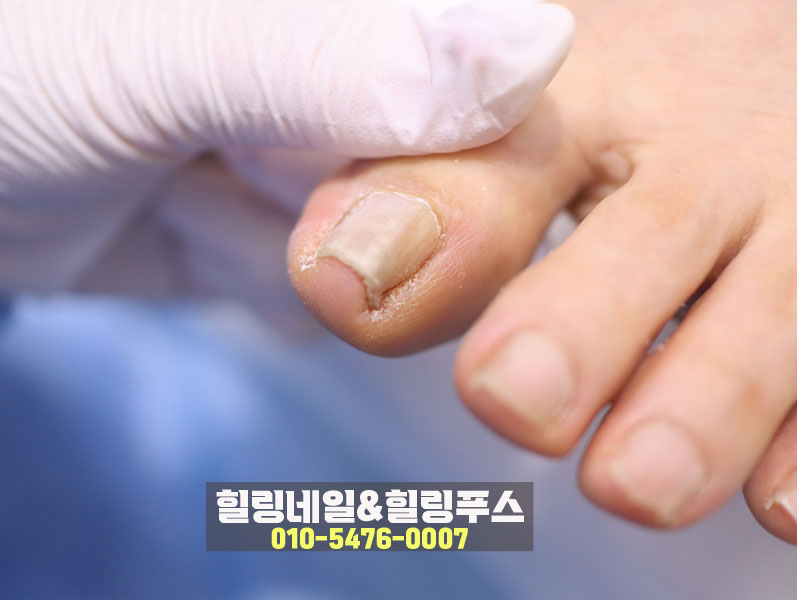 힐링네일&힐링푸스 이미지