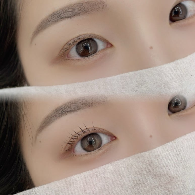 와이오엔 이미지