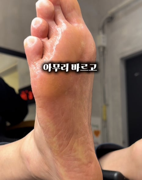 골드문네일 이미지