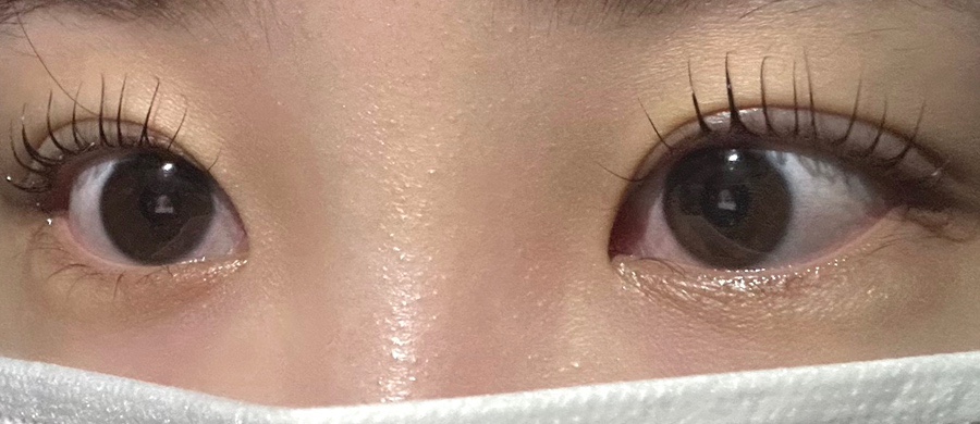 라넌뷰티 이미지