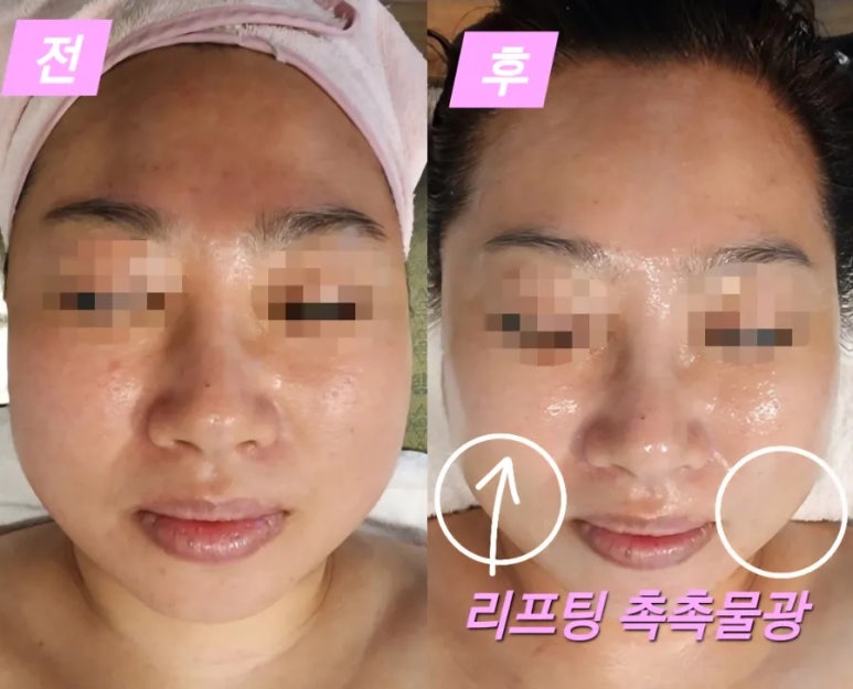 자연미인에스테틱 이미지