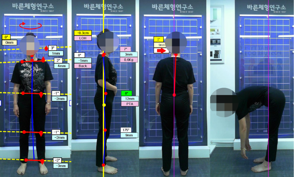 한국바른체형연구소 이미지