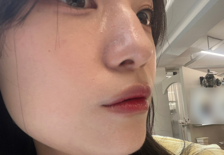 앤드뮤 이미지