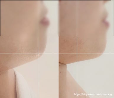 더예쁨에스테틱 이미지