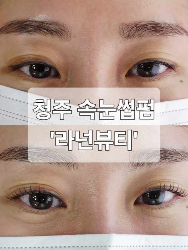 라넌뷰티 이미지