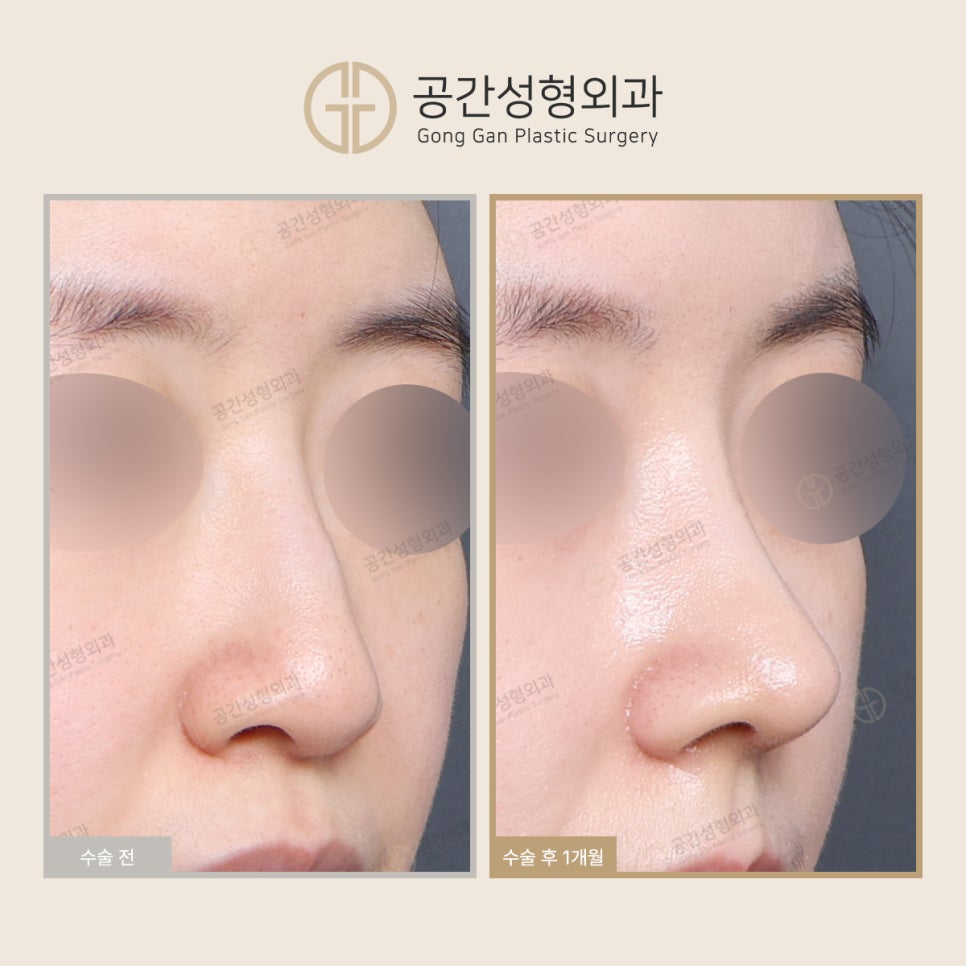 케이스코 이미지