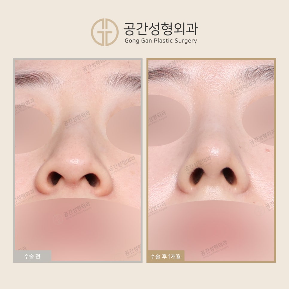 케이스코 이미지