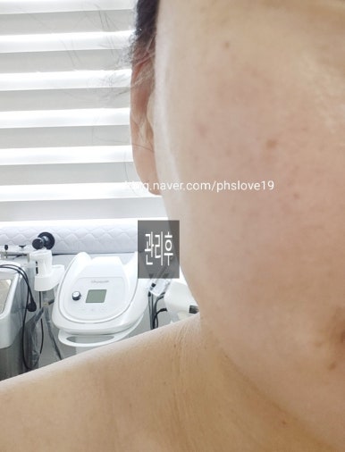 인샵 이미지