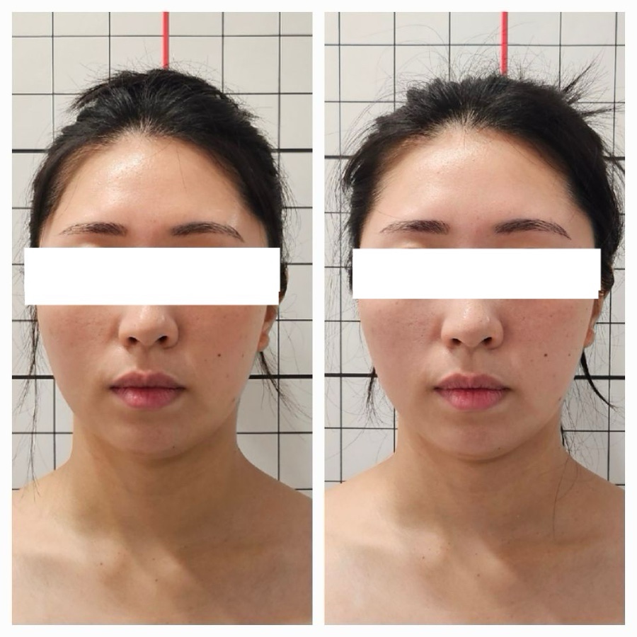 금손체형관리 이미지