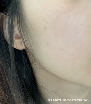 선샤인피부과의원 이미지