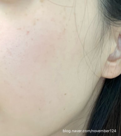 선샤인피부과의원 이미지