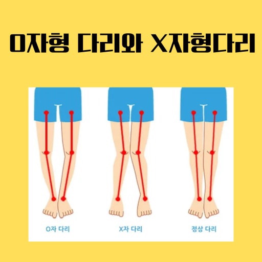 움직임클리닉 이미지