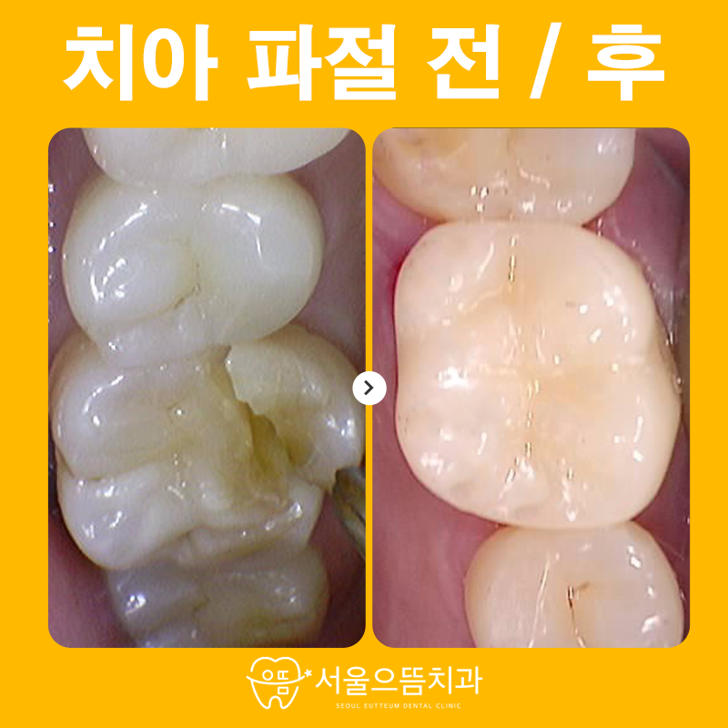 서울으뜸치과의원 이미지