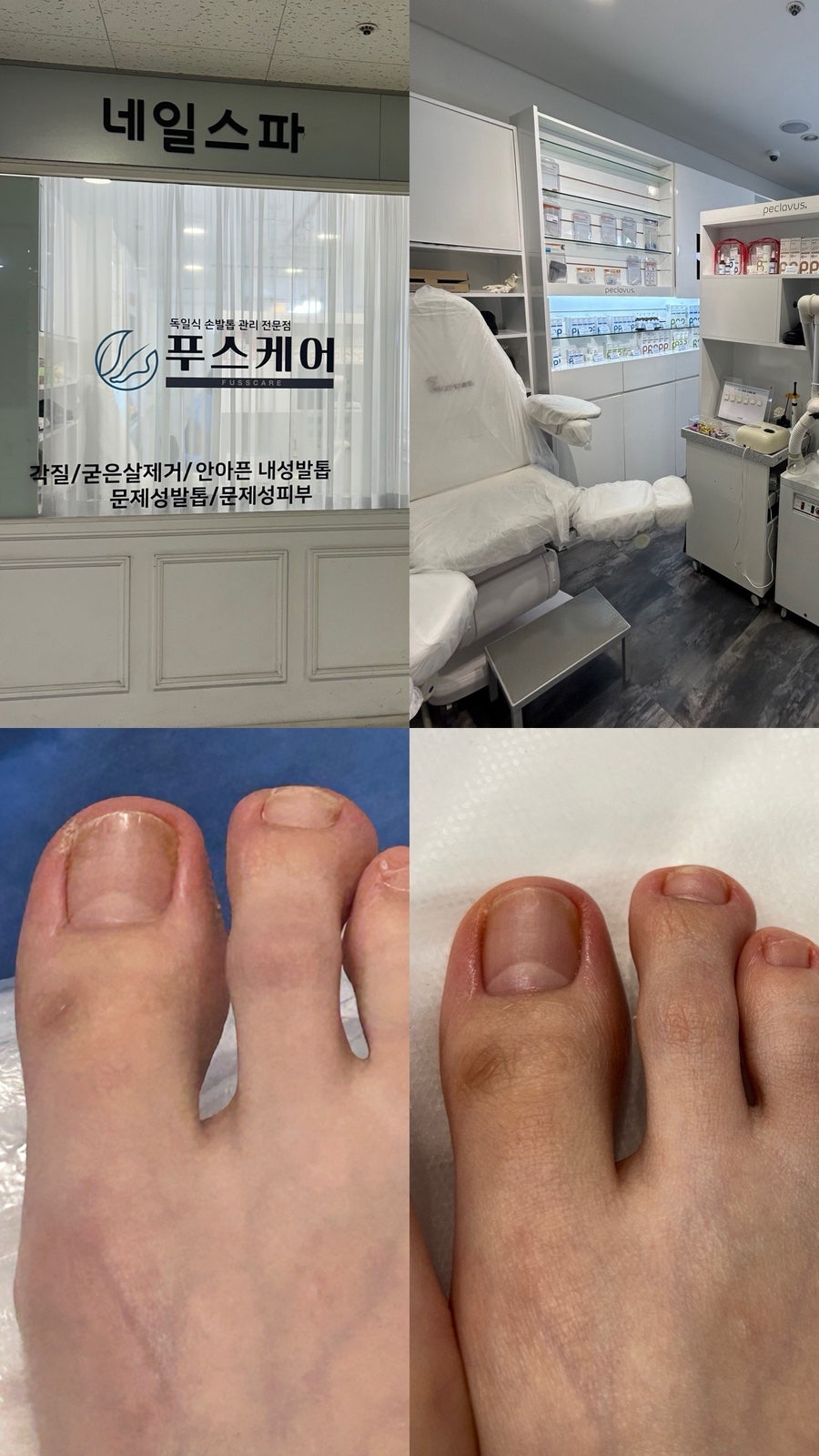 푸스케어 롯데마트제천점 이미지