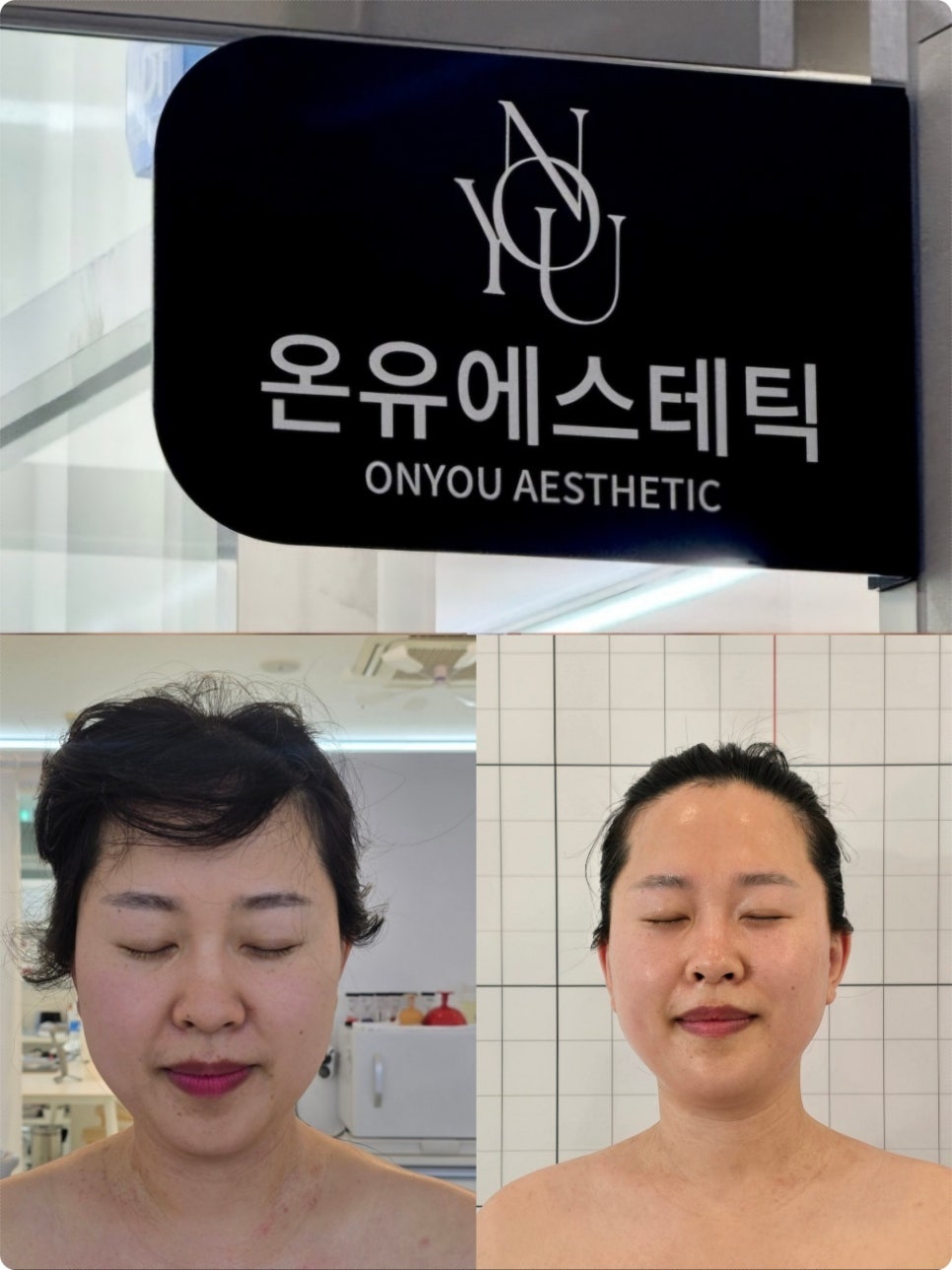 온유에스테틱 이미지