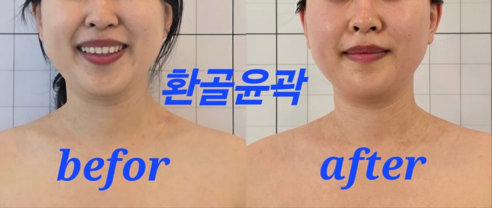 온유에스테틱 이미지