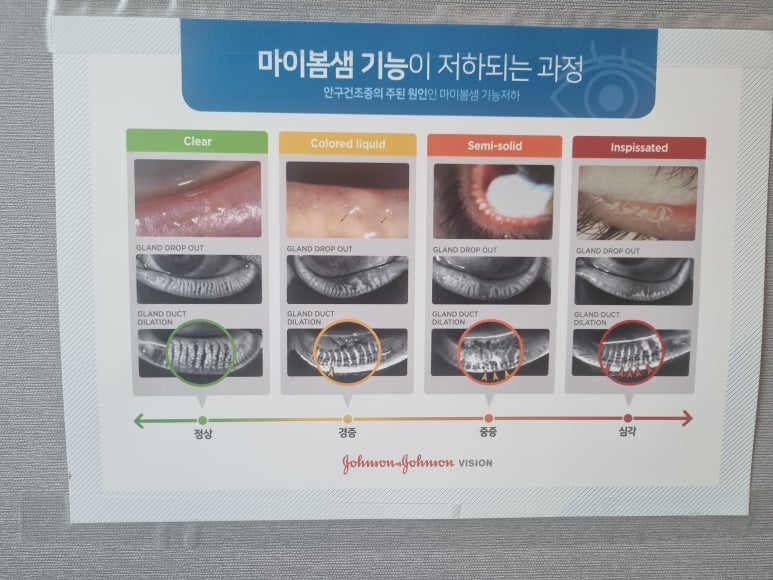 엠에스안과 이미지