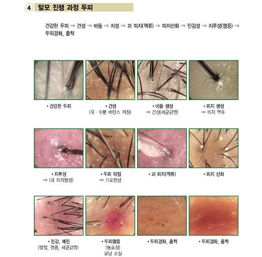 고은솔루션 이미지