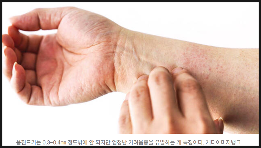 옴 이미지