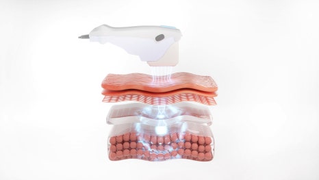 퍼리밀리 이미지