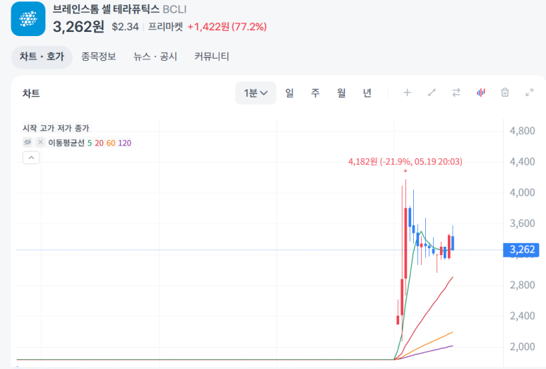 브레인스톰 이미지